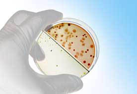 Hand hält eine Petrieschale mit Keimen in ein einem Labor im Ruhrgebiet